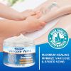 Varicose Veins Cream,Spider Varicose Vein Treatment Cream For Legs,Strengthen Capillary Health, Improve Blood Circulation,Relief Phlebitis Angiitis Inflammation,Tired and Heavy Legs Fast Relief