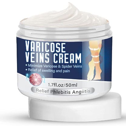 Varicose Veins Cream, Spider Varicose Veins Treatment For Legs, Strengthen Capillary Health, Improve Blood Circulation, Relief Phlebitis Angiitis Inflammation, Tired and Heavy Legs Fast Relief