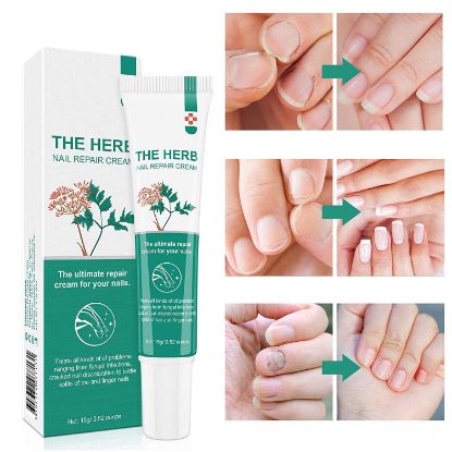 Nail Repair Cream,Toenail Treatment for Toenails and Fingernails,Fix & Renew Damaged, Broken, Cracked & Discolored Nails