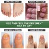 Toenail Fungus Treatment,Effective Fingernail & Toenail Repair Hydrates, Stopping Fungus Growth and Restore Healthy Nails