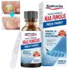 Picture of Toenail Fungus Treatment, Extra Strength Nail Repair Liquid for Toenail and Fingernail, Repairs and Renew Damaged, Broken, Cracked & Discolored Nails