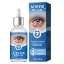 Picture of Stye Eye Treatment (30 ml)